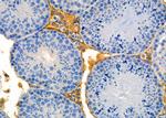 GCKR Antibody in Immunohistochemistry (Paraffin) (IHC (P))