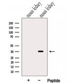 C17orf25 Antibody in Western Blot (WB)