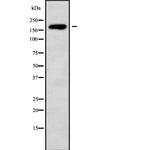 HECW1 Antibody in Western Blot (WB)