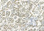 HKR1 Antibody in Immunohistochemistry (Paraffin) (IHC (P))