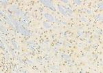 HKR1 Antibody in Immunohistochemistry (Paraffin) (IHC (P))