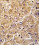 ALDH1A1 Antibody in Immunohistochemistry (Paraffin) (IHC (P))