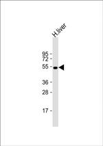 ALDH1A1 Antibody in Western Blot (WB)