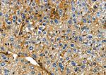 HSD17B1 Antibody in Immunohistochemistry (Paraffin) (IHC (P))