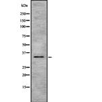 HSD17B1 Antibody in Western Blot (WB)