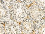 HtrA1 Antibody in Immunohistochemistry (Paraffin) (IHC (P))