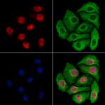 Importin 7 Antibody in Immunocytochemistry (ICC/IF)