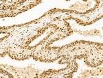 Importin 7 Antibody in Immunohistochemistry (Paraffin) (IHC (P))