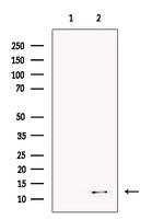 Kappa Light Chain Antibody in Western Blot (WB)