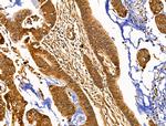 KCNN2 Antibody in Immunohistochemistry (Paraffin) (IHC (P))