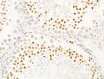 JARID1C Antibody in Immunohistochemistry (Paraffin) (IHC (P))