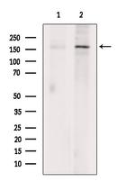 JARID1C Antibody in Western Blot (WB)