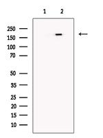 JARID1C Antibody in Western Blot (WB)