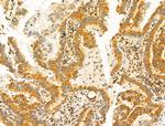 KV1.3 (KCNA3) Antibody in Immunohistochemistry (Paraffin) (IHC (P))