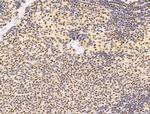 L3MBTL1 Antibody in Immunohistochemistry (Paraffin) (IHC (P))