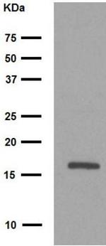 LC3B Antibody in Western Blot (WB)