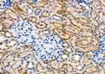 LDLR Antibody in Immunohistochemistry (Paraffin) (IHC (P))