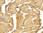 LIFR Antibody in Immunohistochemistry (Paraffin) (IHC (P))