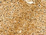 LIFR Antibody in Immunohistochemistry (Paraffin) (IHC (P))