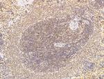MBD4 Antibody in Immunohistochemistry (Paraffin) (IHC (P))
