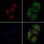 MUM1 Antibody in Immunocytochemistry (ICC/IF)