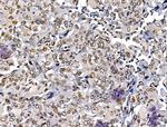 MUM1 Antibody in Immunohistochemistry (Paraffin) (IHC (P))