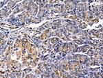 MUM1 Antibody in Immunohistochemistry (Paraffin) (IHC (P))