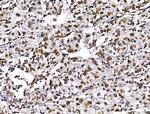 MUM1 Antibody in Immunohistochemistry (Paraffin) (IHC (P))