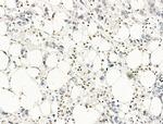 MUM1 Antibody in Immunohistochemistry (Paraffin) (IHC (P))