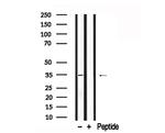 MYOD Antibody in Western Blot (WB)