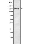 CD56 Antibody in Western Blot (WB)