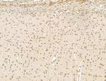 Nesprin 1 Antibody in Immunohistochemistry (Paraffin) (IHC (P))