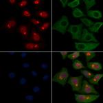 Neutrophil elastase Antibody in Immunocytochemistry (ICC/IF)