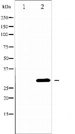 Neutrophil elastase Antibody in Western Blot (WB)