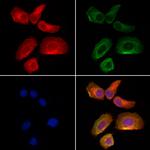 Optineurin Antibody in Immunocytochemistry (ICC/IF)