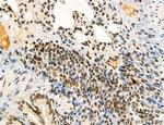 SP7 Antibody in Immunohistochemistry (Paraffin) (IHC (P))