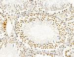 SP7 Antibody in Immunohistochemistry (Paraffin) (IHC (P))