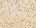 SP7 Antibody in Immunohistochemistry (Paraffin) (IHC (P))