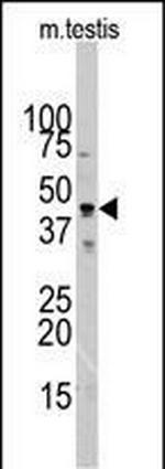 Actin Antibody in Western Blot (WB)