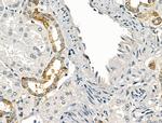 P2X2 Antibody in Immunohistochemistry (Paraffin) (IHC (P))