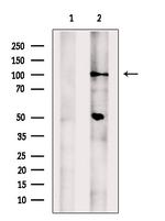 PDE11A Antibody in Western Blot (WB)