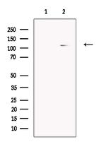 PDE11A Antibody in Western Blot (WB)