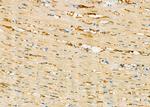 PIWIL4 Antibody in Immunohistochemistry (Paraffin) (IHC (P))