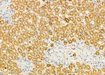 PIWIL4 Antibody in Immunohistochemistry (Paraffin) (IHC (P))