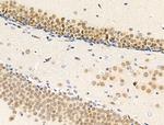 RECQL5 Antibody in Immunohistochemistry (Paraffin) (IHC (P))