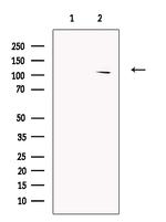 RECQL5 Antibody in Western Blot (WB)