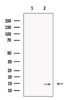 SAA2 Antibody in Western Blot (WB)