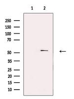 SEC61A1 Antibody in Western Blot (WB)