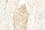 SNAIL Antibody in Immunohistochemistry (Paraffin) (IHC (P))