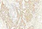 SNAIL Antibody in Immunohistochemistry (Paraffin) (IHC (P))